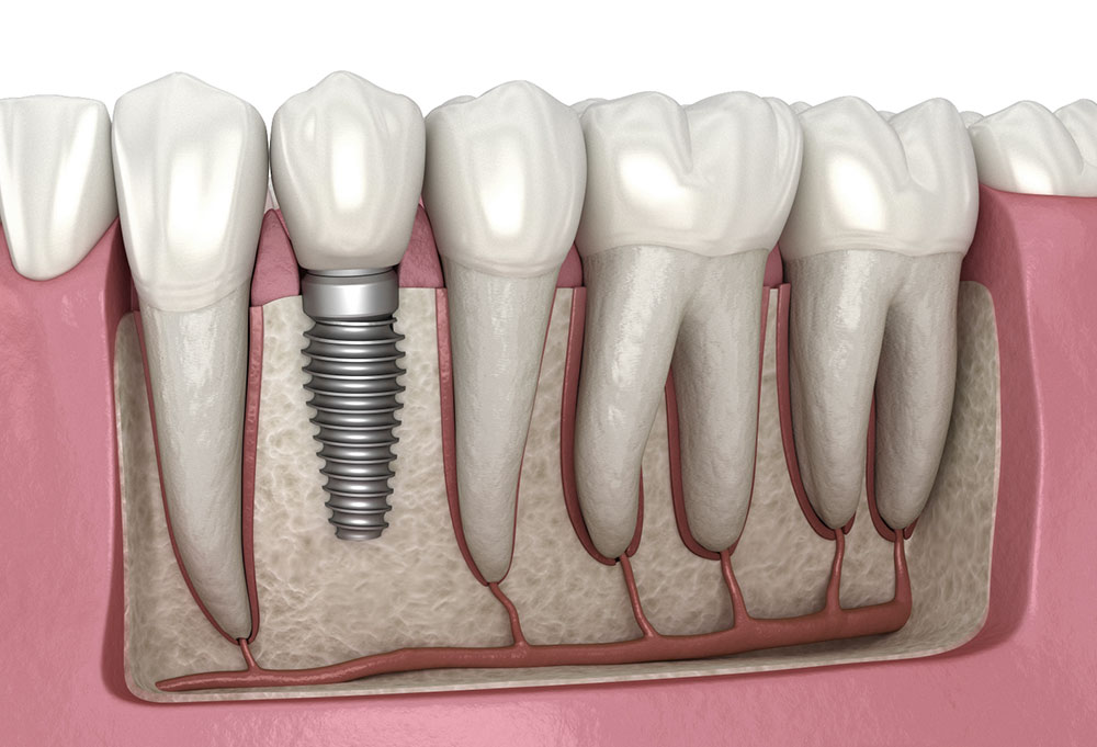 The Importance of Regular Dental Checkups