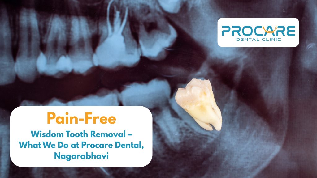 Pain-Free Wisdom Tooth Removal – What We Do at Procare Dental, Banashankari
