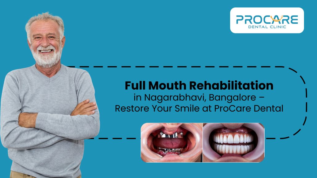 Full Mouth Rehabilitation in Banashankari, Bangalore – Restore Your Smile at ProCare Dental